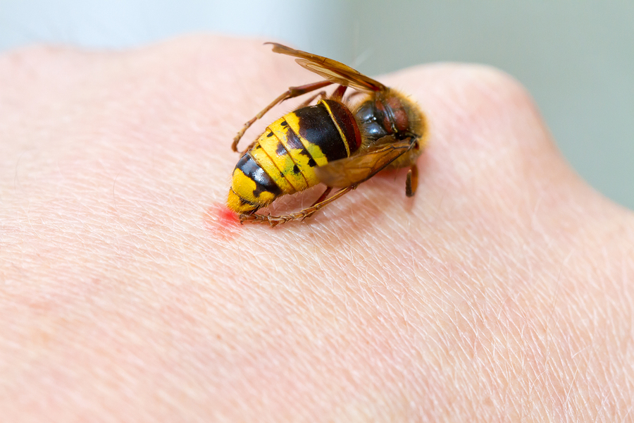 4 Common Summer Stinging Pests