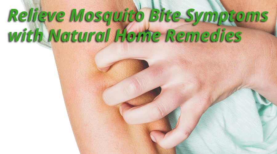 Natural Home Remedies for Mosquito Bites