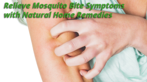 natural mosquito bite remedies