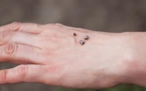 flea tick bites