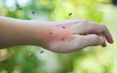 How To Avoid Mosquito Bites this Summer