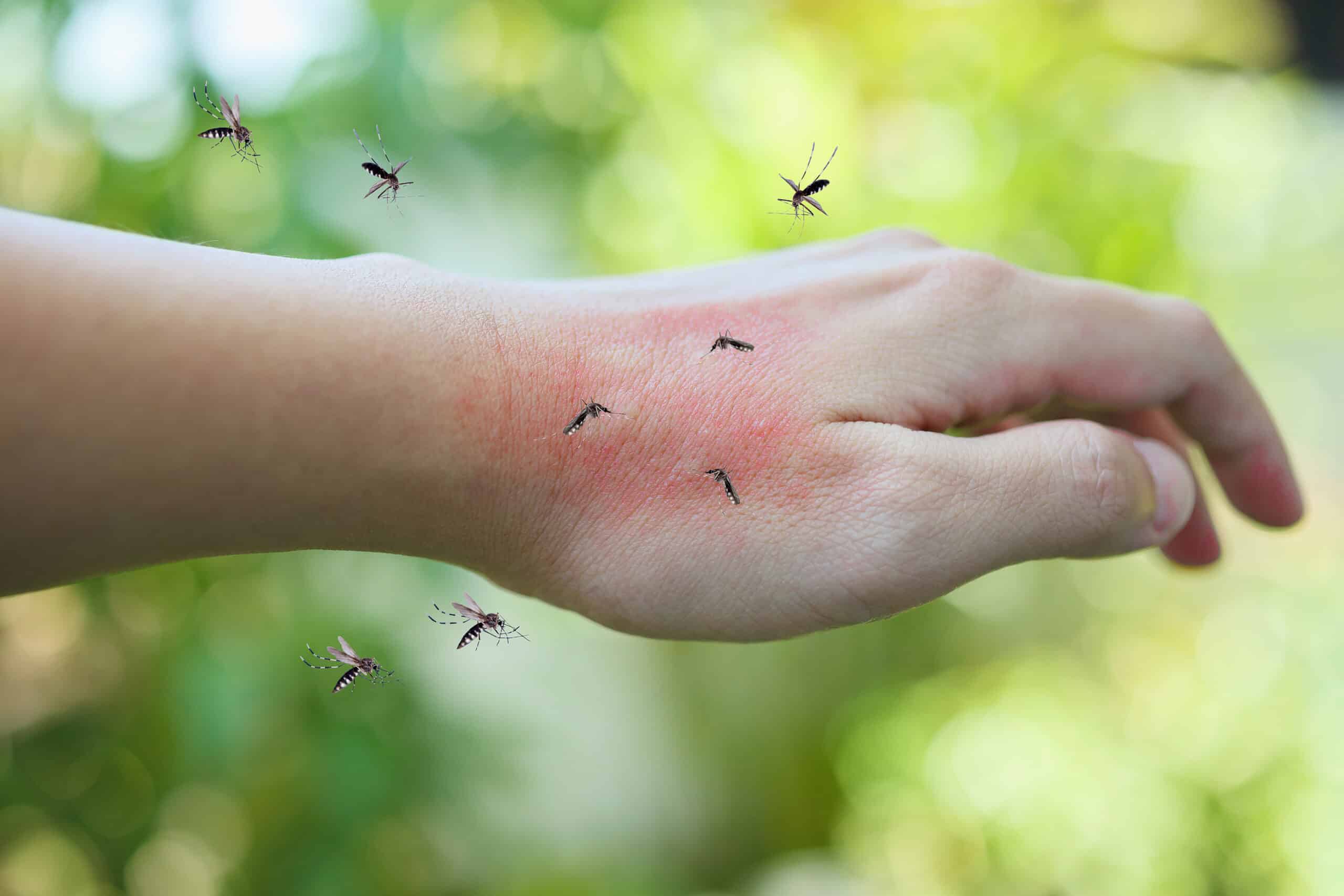 Mosquito bites discount